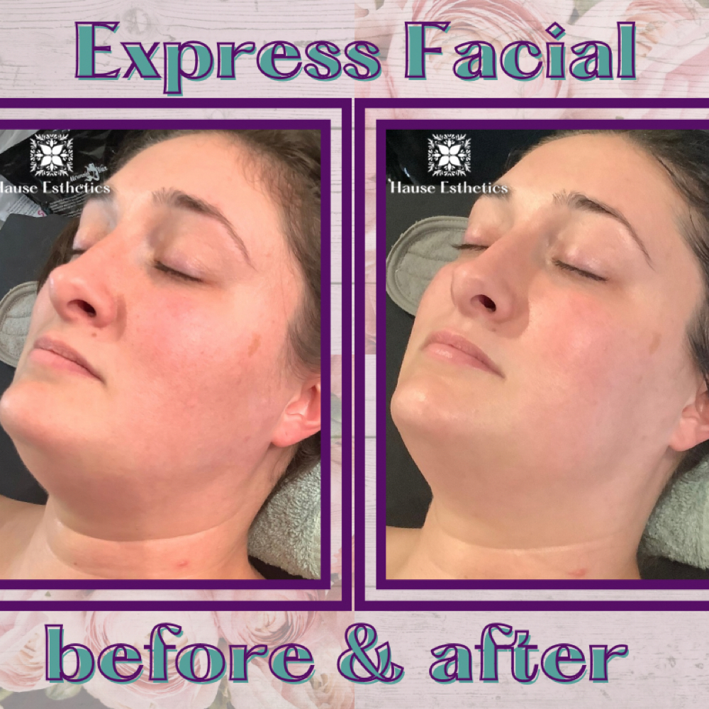 Express Facials at Hause Esthetics in Morristown, TN
