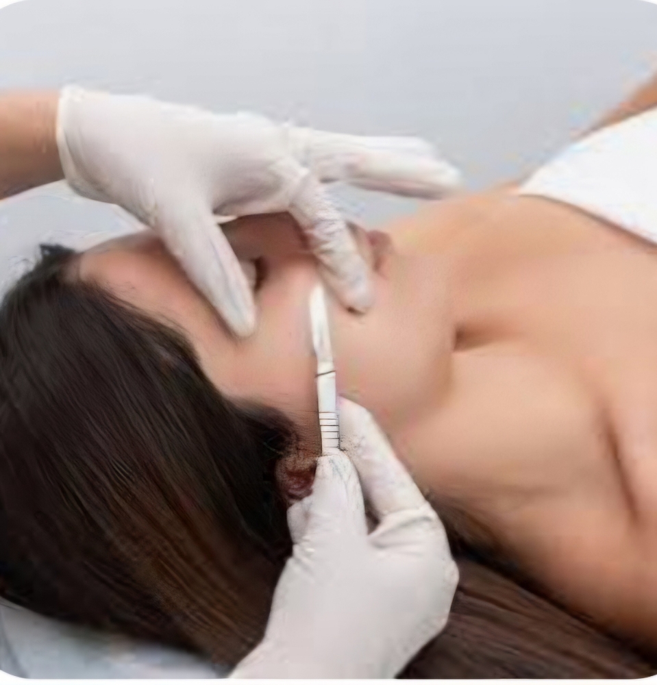 Dermaplan