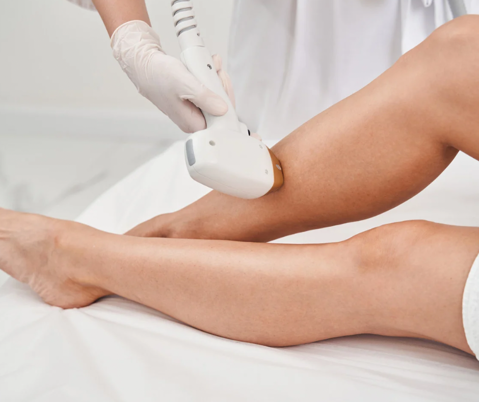 Laser Hair Removal Legs Half