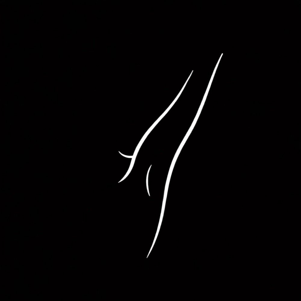 Underarms at NAUMA Skin & Laser Studio in Rockledge, FL