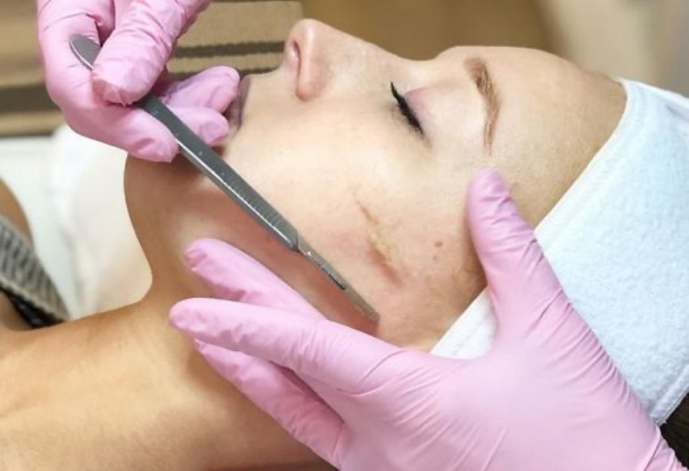 Only dermaplane 30min