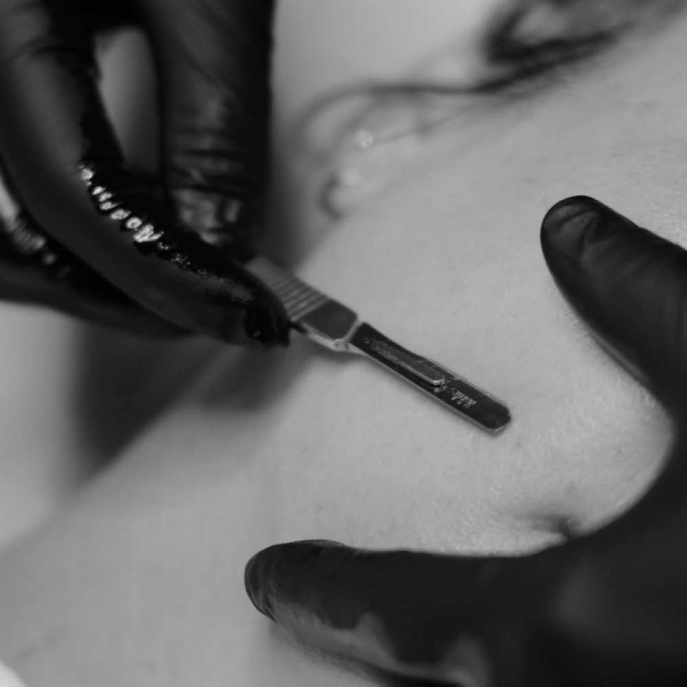 Facial w/ Dermaplane at Emma’s Esthetics in Gadsden, AL