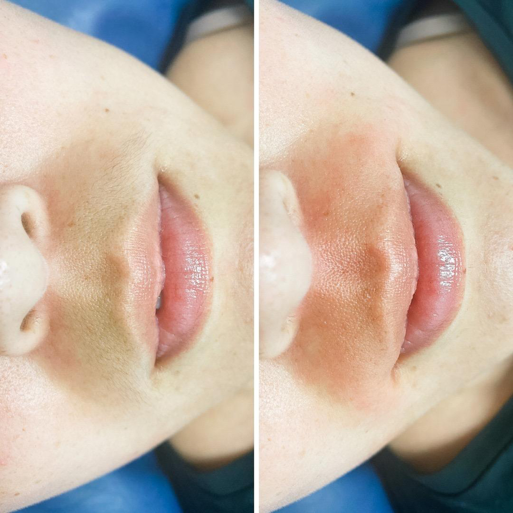 Lip Wax