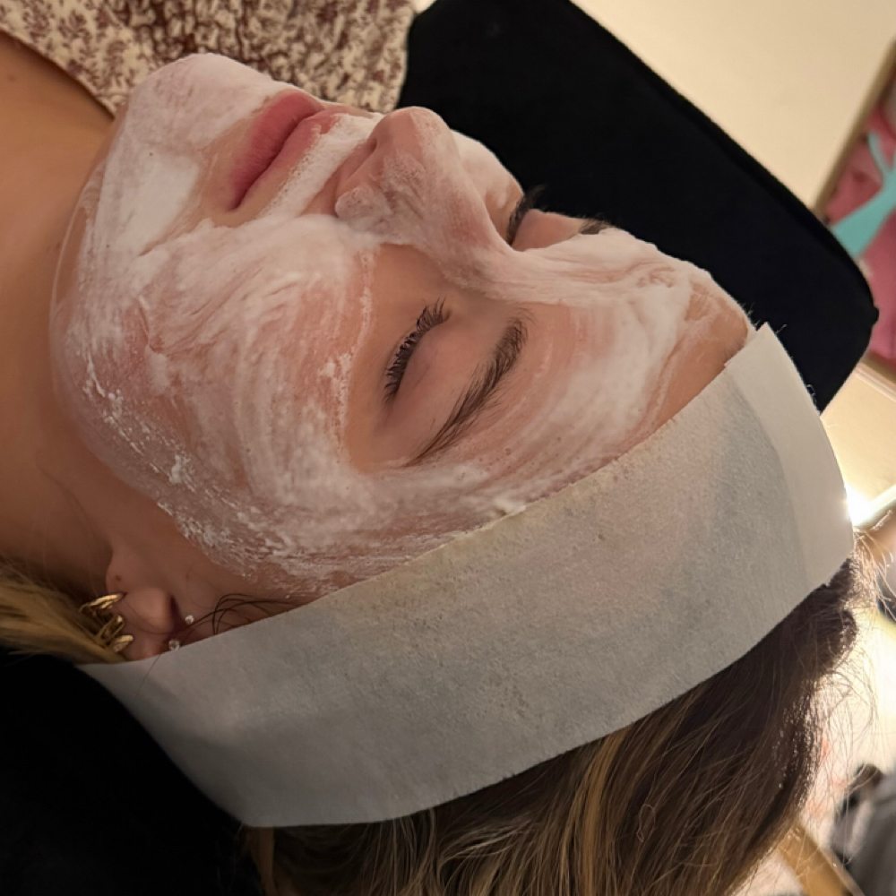 Acne Facial at Lexibelleskin in St George, UT