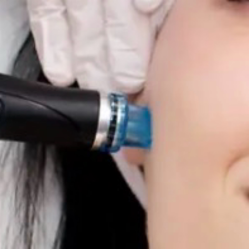 Glacial Glow Facial at Alpine Glow Aesthetics, LLC in Colorado Springs, CO
