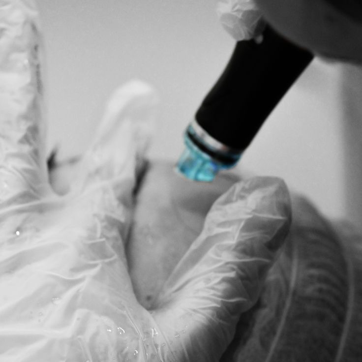 Deluxe Hydrafacial at ABC Aesthetics in Baltimore, MD