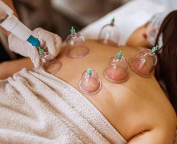 Cupping at Lotus Therapeutics Massage in Grand Junction, CO