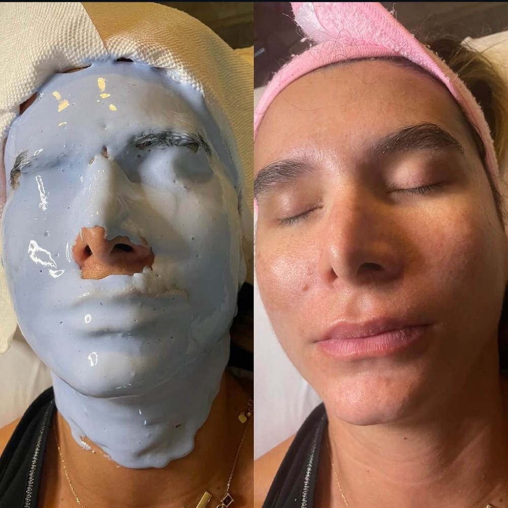 Facial + Hidroplástica at Diana Bella LLC in Deerfield Beach, FL