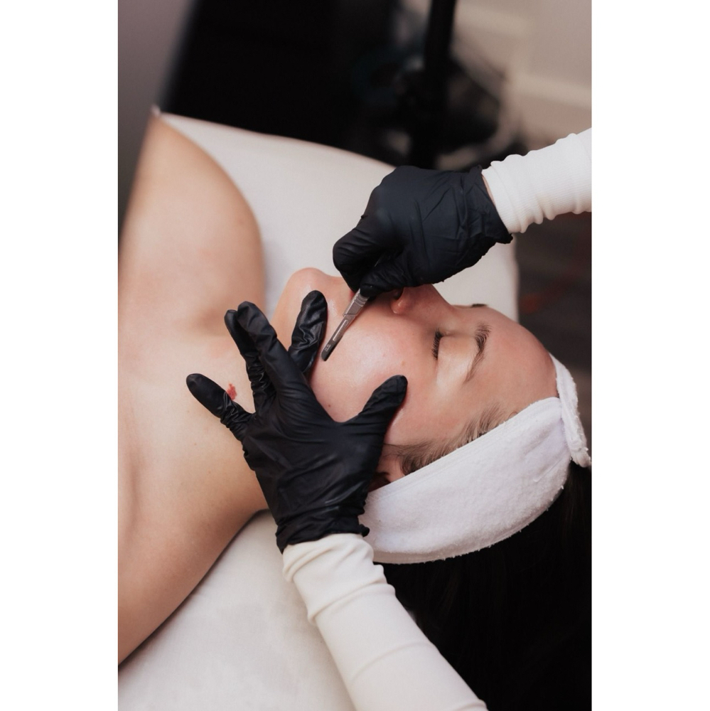 Dermaplaning