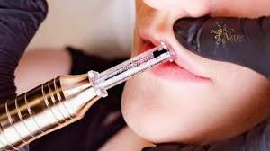 Body-Lip Filler