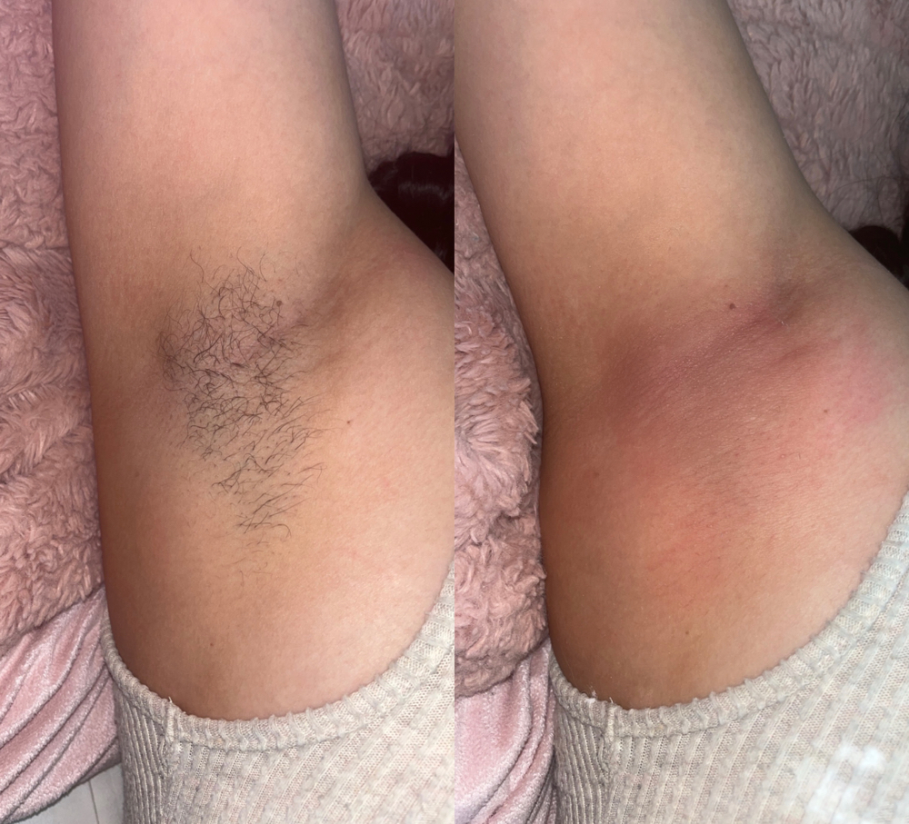 Under arm