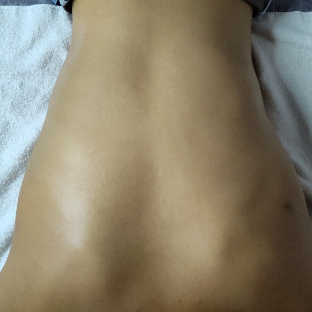 Backcial at Beautyfull Esthetics in Riverside, CA