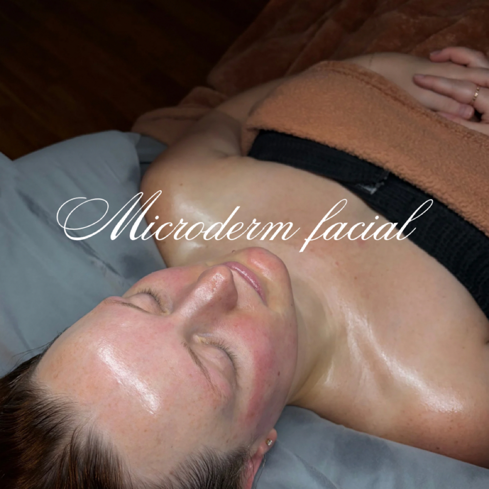 Microdermabrasion Facial at Ella Atwell Esthetics, LLC. in Kingsport, TN