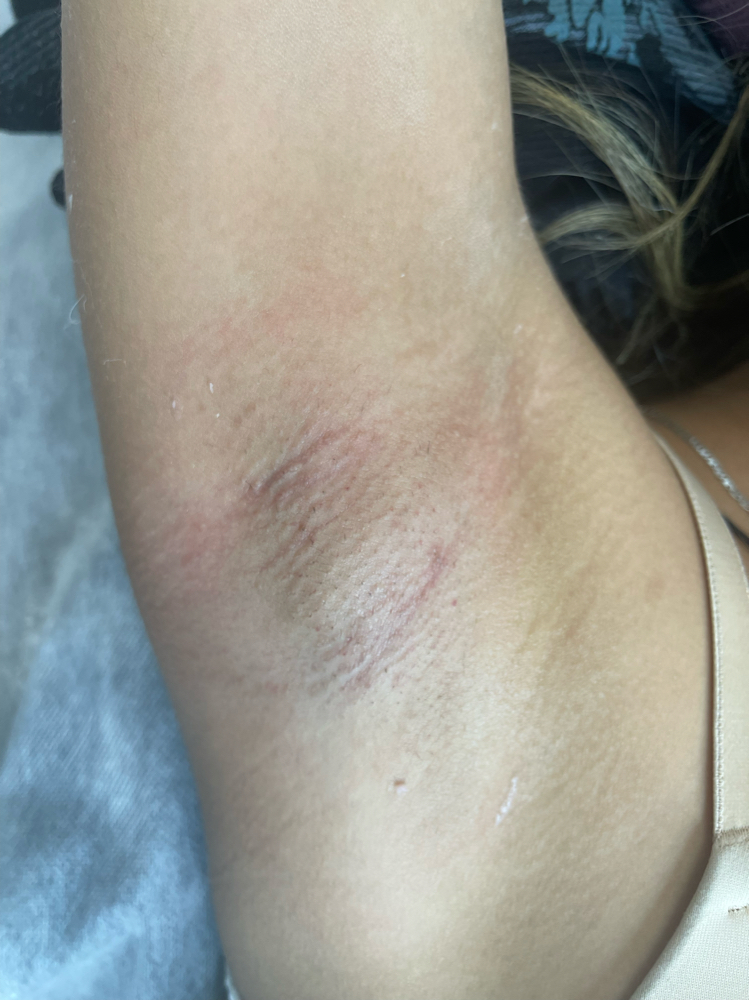 Under Arm Wax