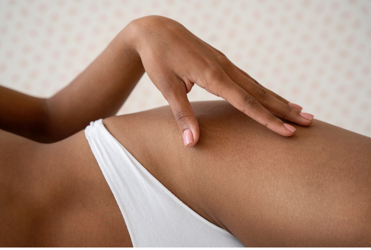 Bikini Hair Removal