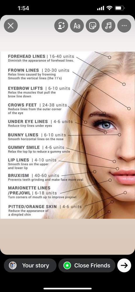 Crows Feet ( Lines Next To Eyes)