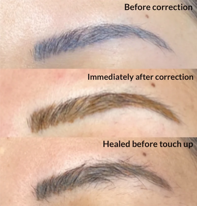 Permanent Makeup Correction PA