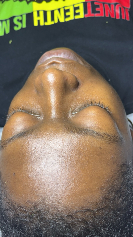 The Junior (Dermaplane)