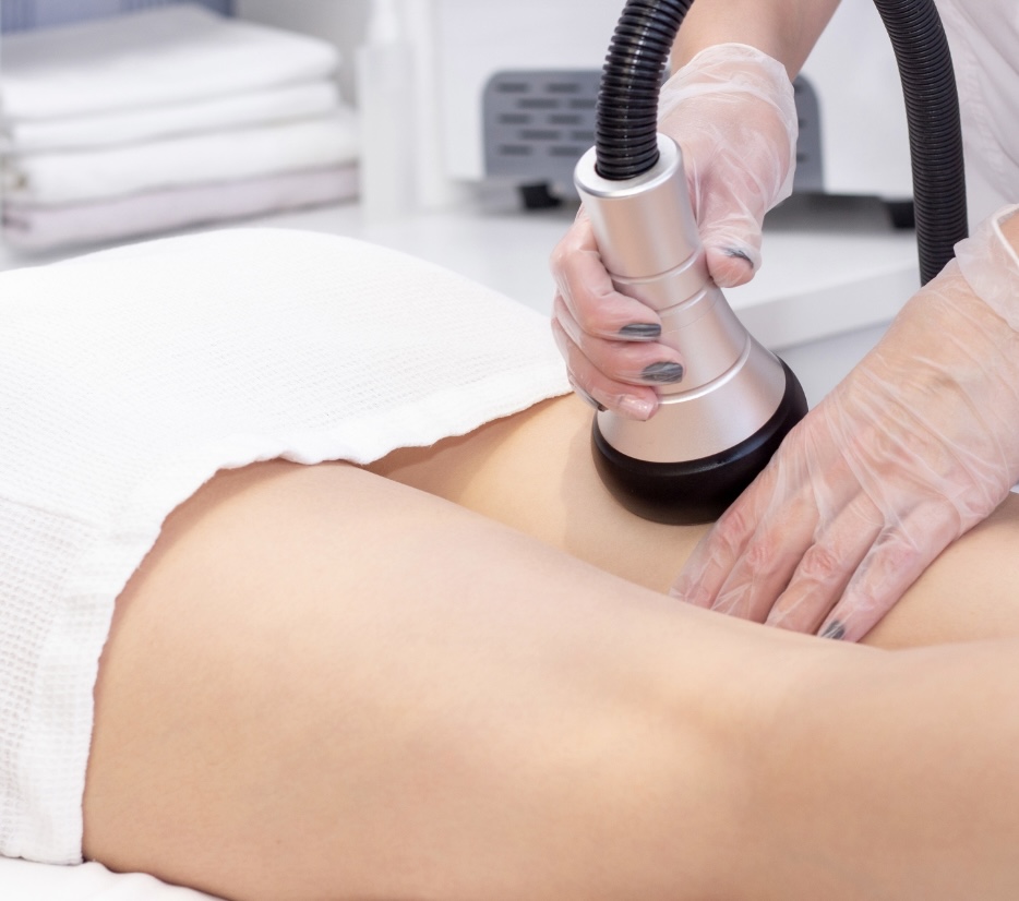The Cellulite Killer 1 Session