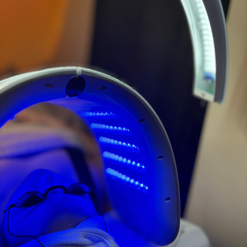 Acne Treatment at Ran With Beauty in Chester, PA