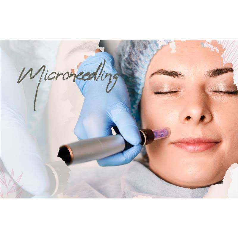 Microneedling