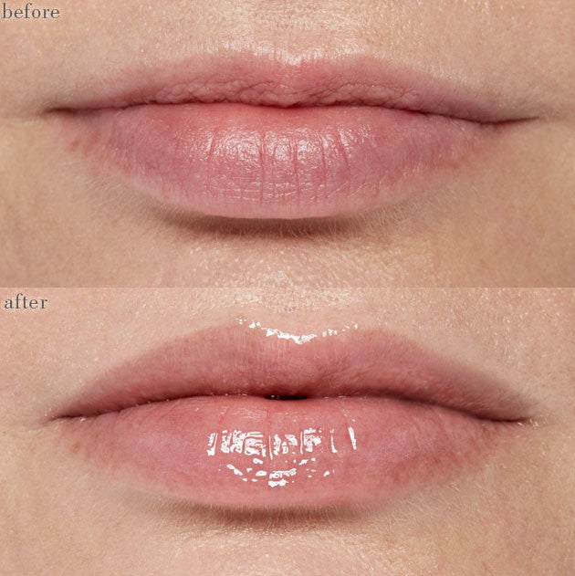 Facial: Peptide lip plump