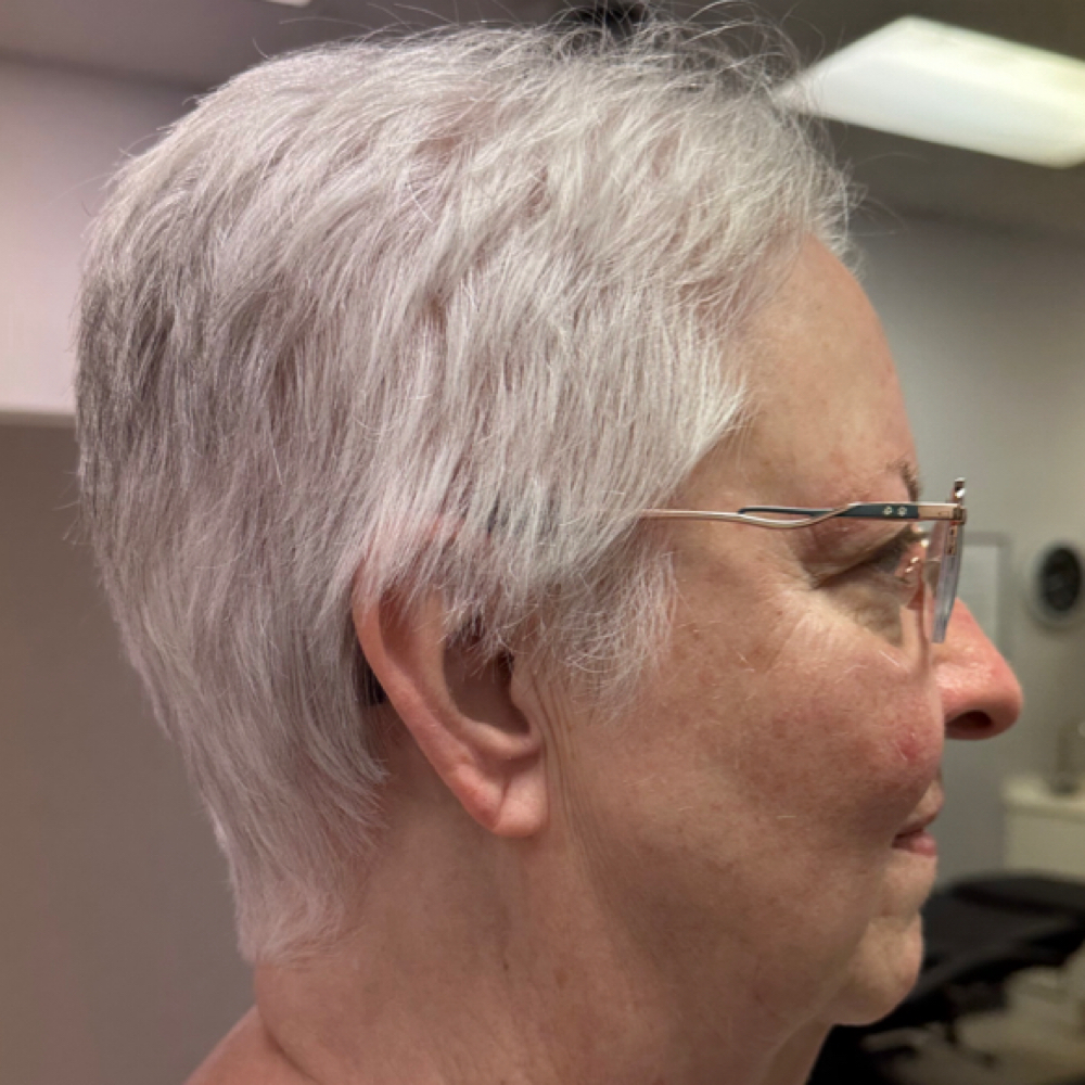Scalp Treatment at Ryan Leach in Staunton, VA