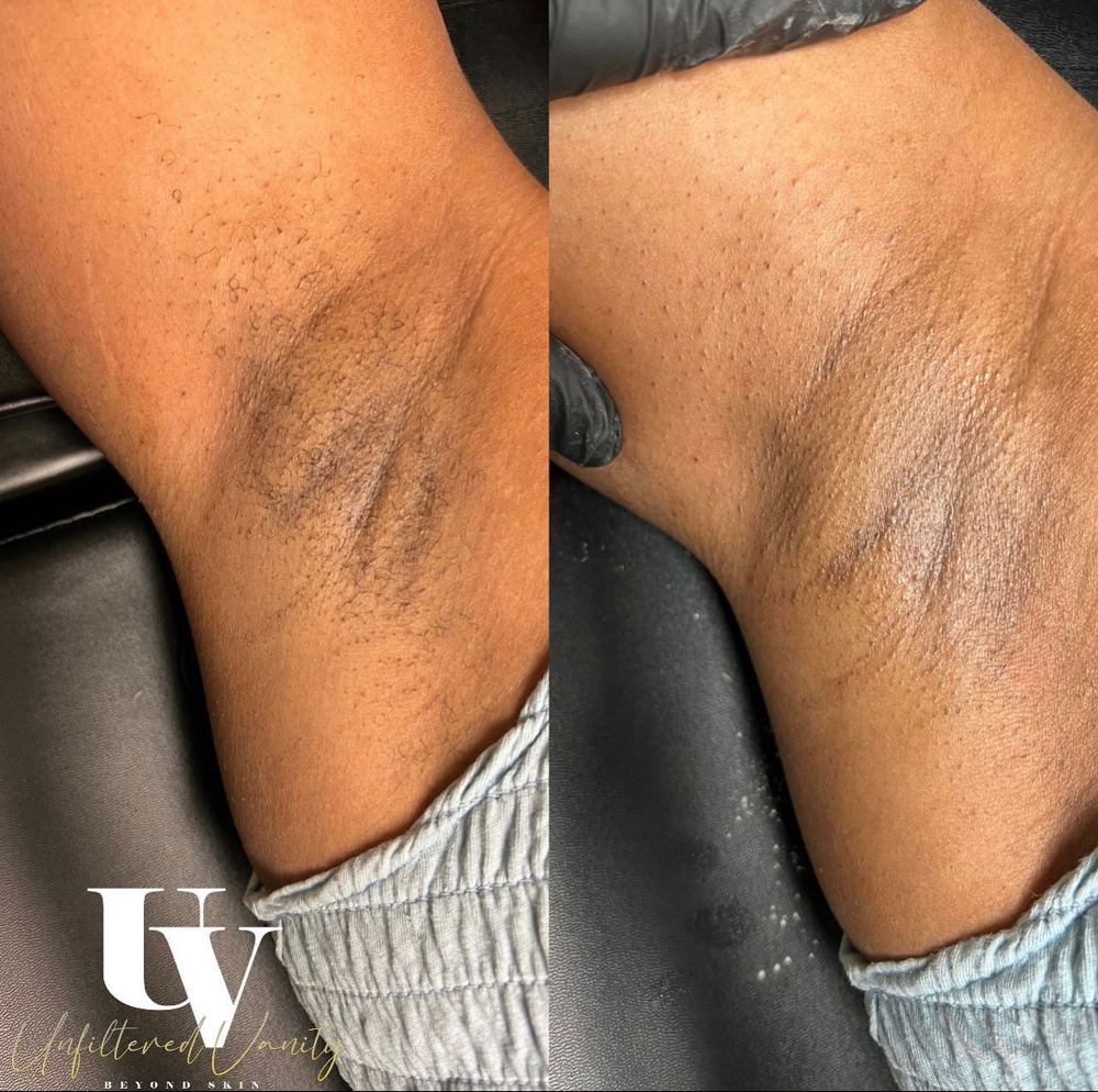 Under Arm Wax