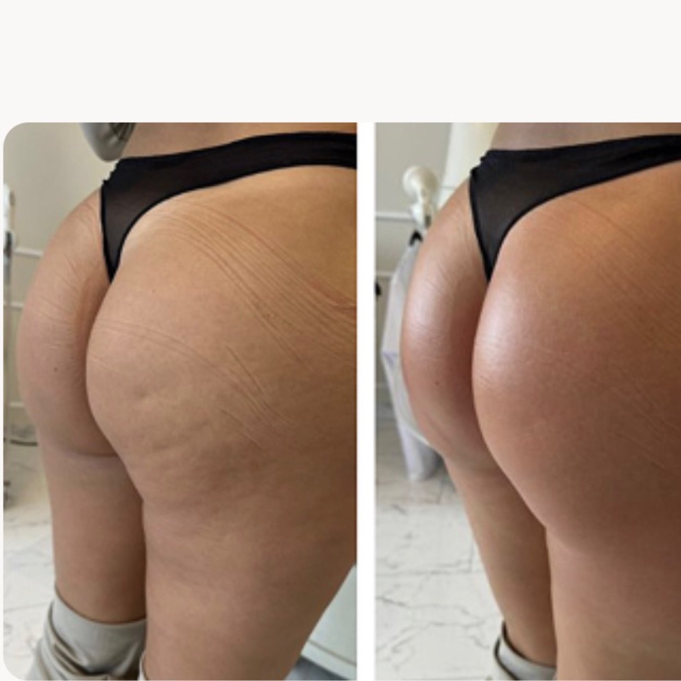 ESVELTE at REMAKE BEAUTY STUDIO in San antonio, TX
