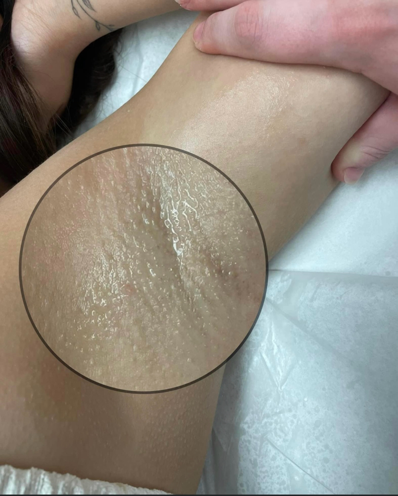 Underarm Wax