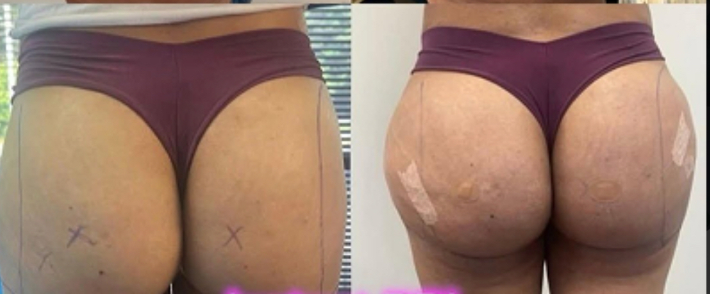 Istant HIP DIP RESULT