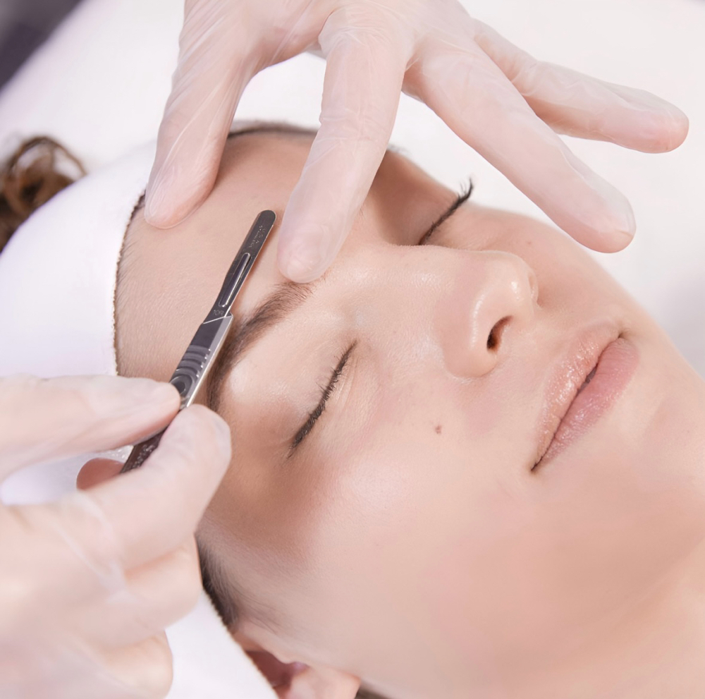 Dermaplaning