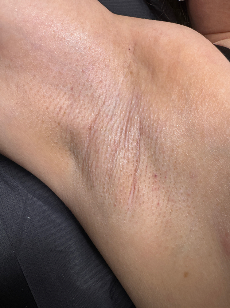 Under Arm Wax