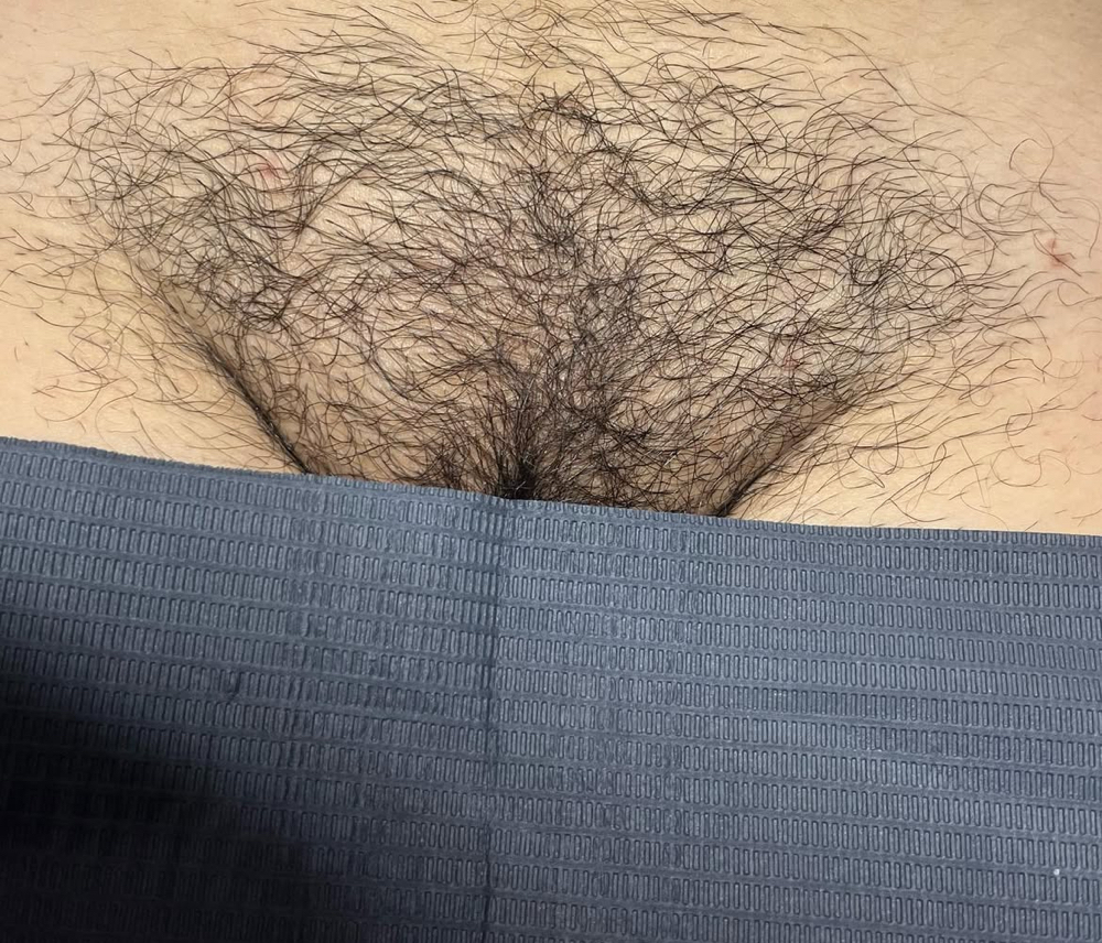 Bikini Line Wax