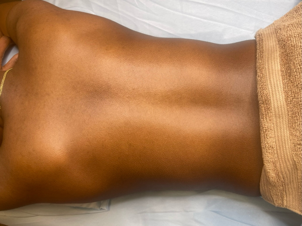 Purifying Back Treatment