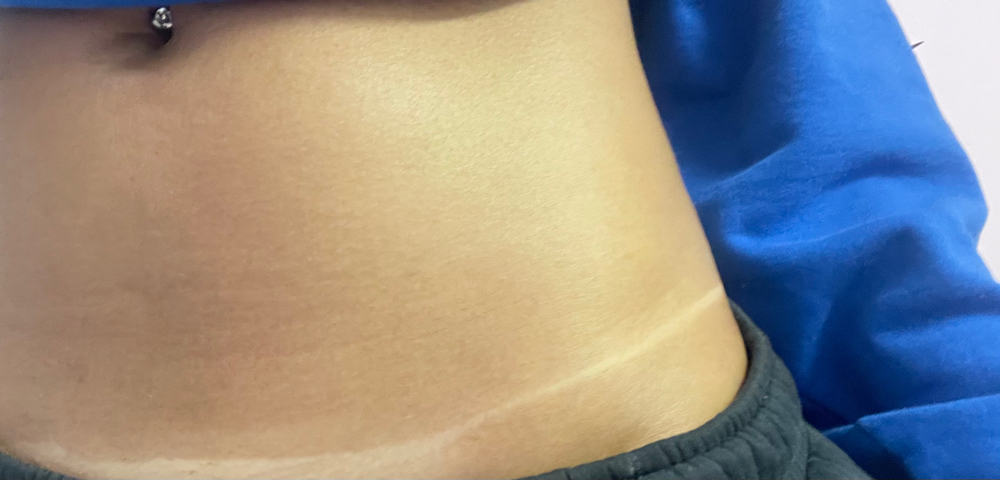 Spray Tan