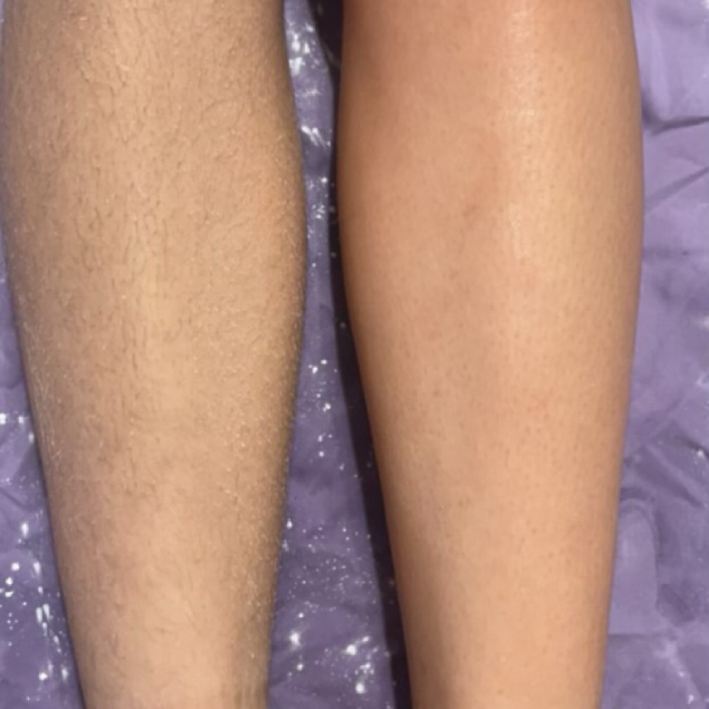 Full Leg Wax at Melanin Beauty Bar in La Crosse, WI