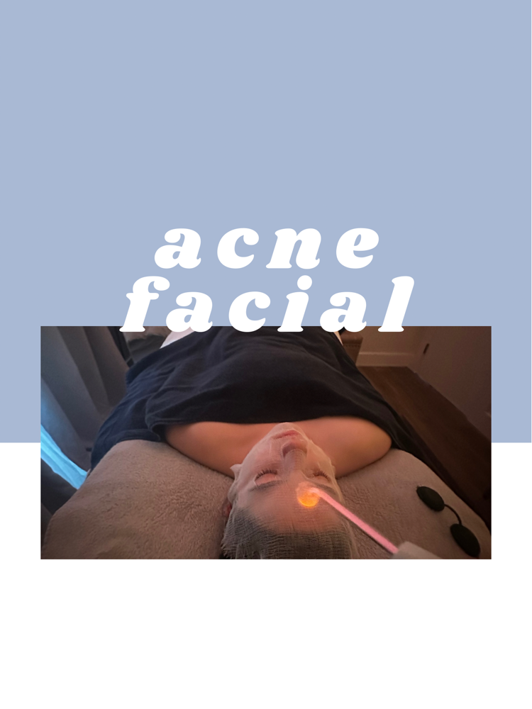 Acne Facial