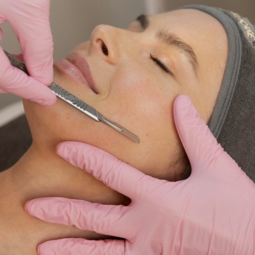 Dermaplaning Treatment at Boujee Asthetics ✨ in Tucson, AZ