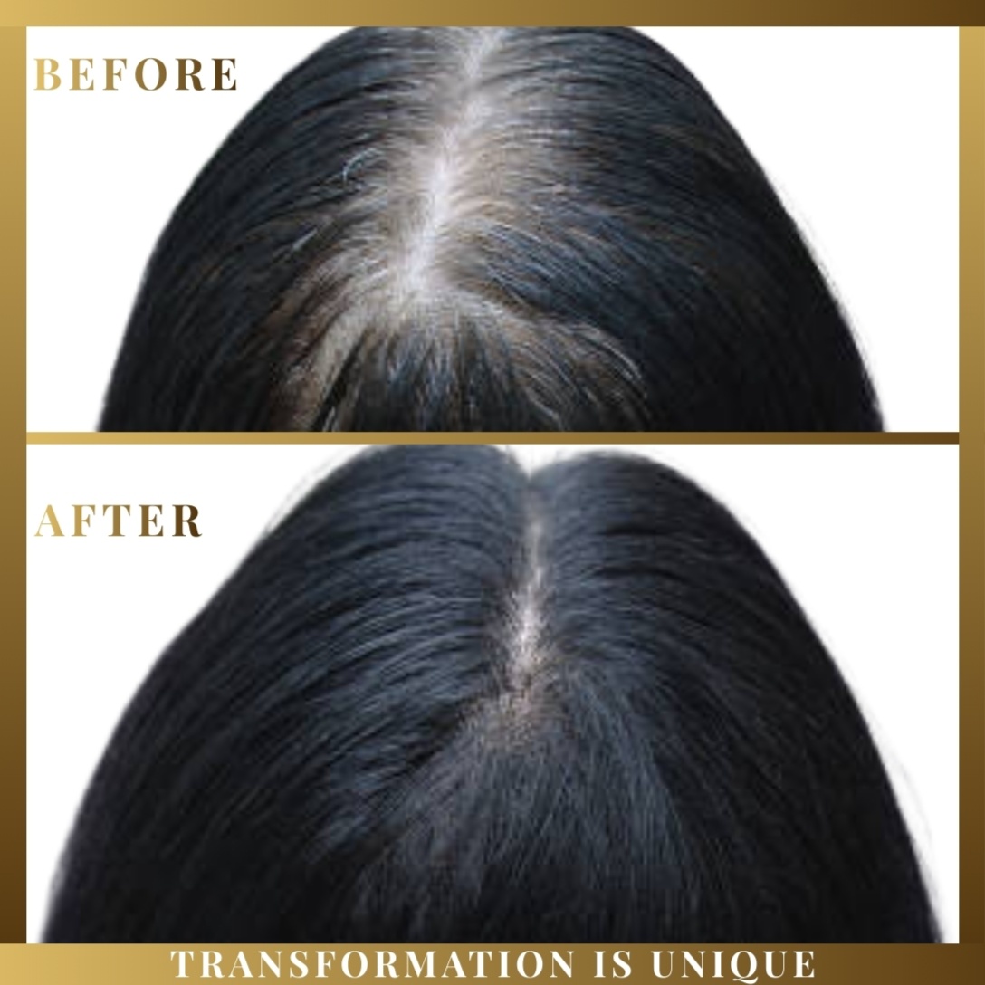 SMP Crown Confidence Fill