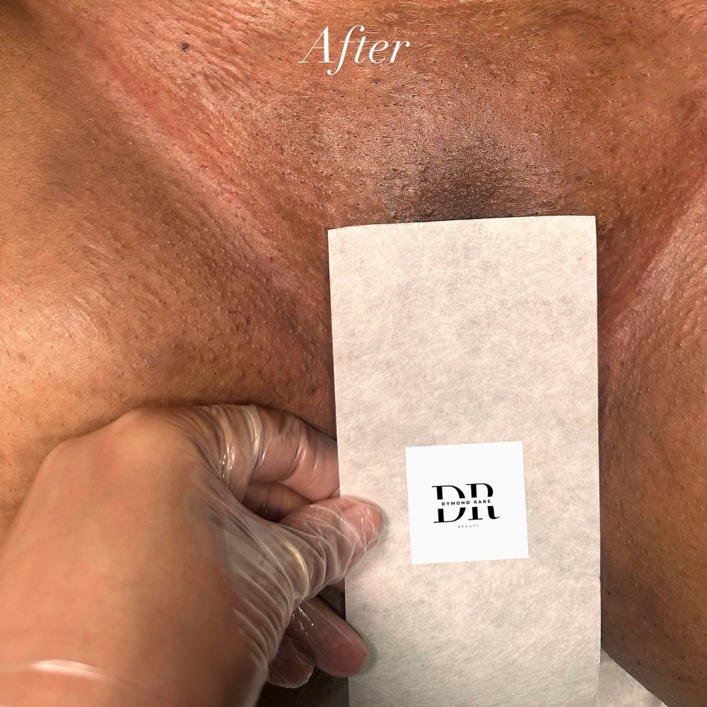 🍯 Brazilian Wax at Dymond Rare Beauty in Whiteville, NC