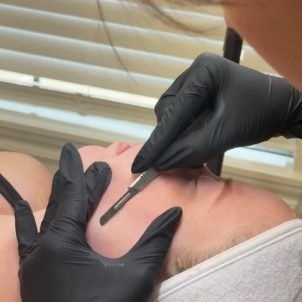 Dermaplane Facial at Kate Anderson Esthetics in Oklahoma City, OK
