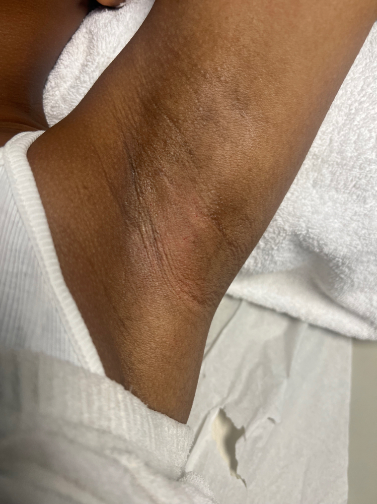 Underarm Wax