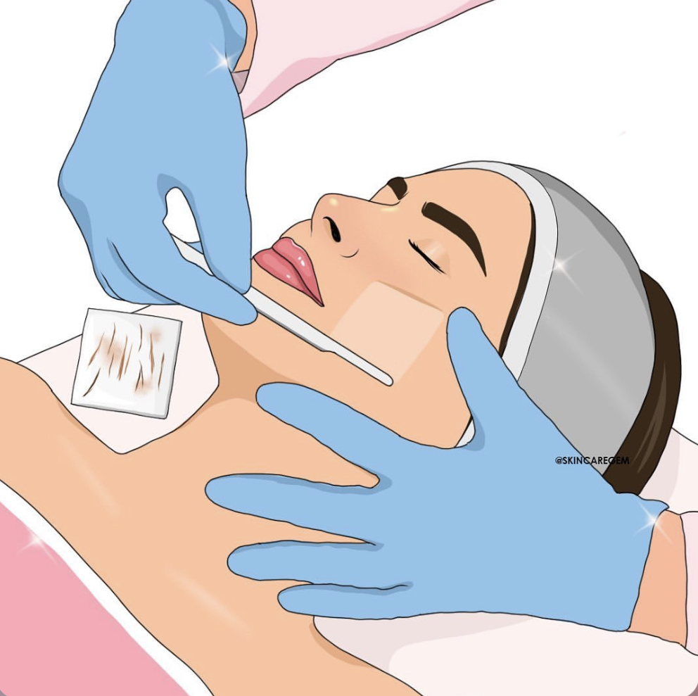 Dermaplaning