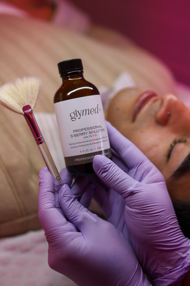 Chemical Peel Jesners