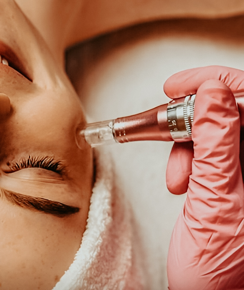 Microdermabrasion Facial