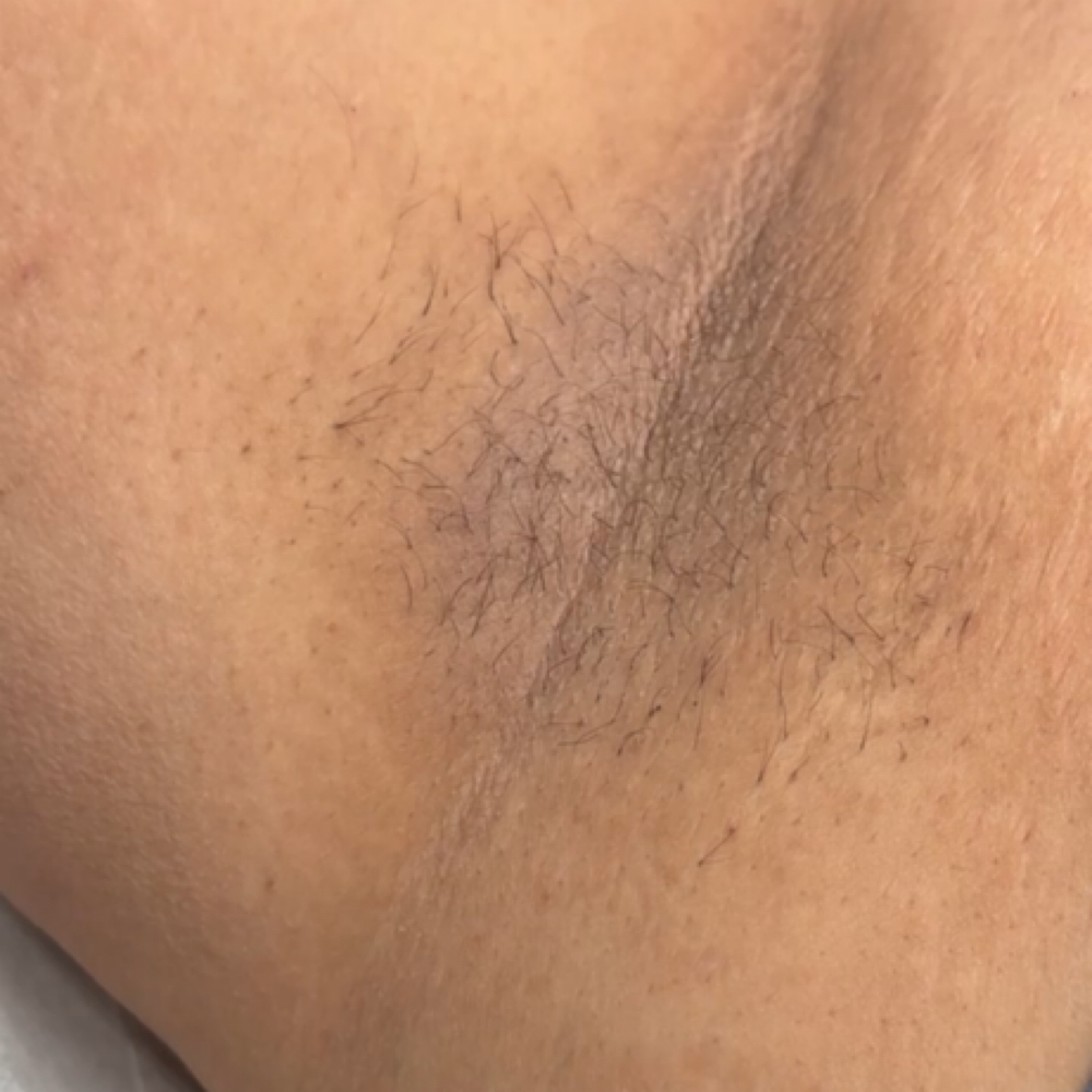Underarm Wax at Diamond Eclipse Acrylics in Freer, TX