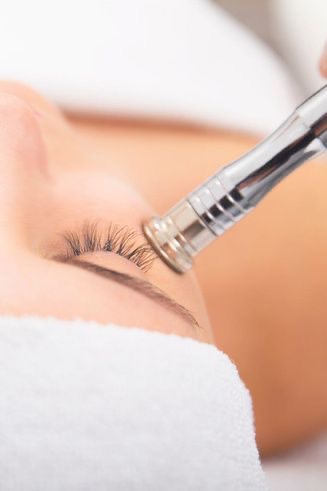 Microdermabrasion facial