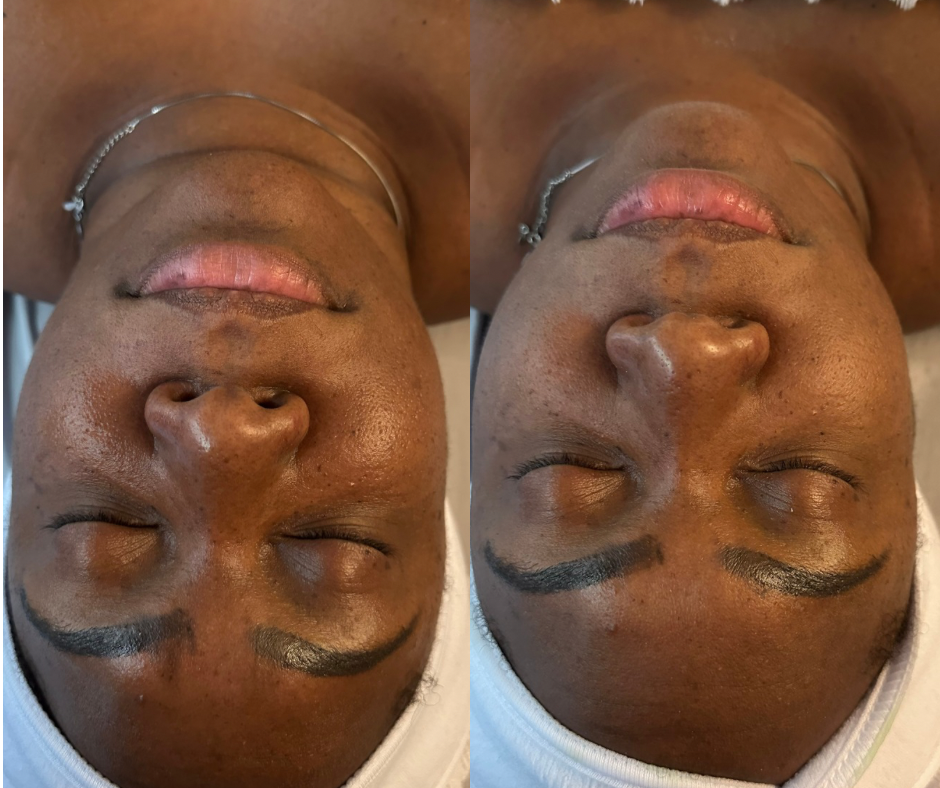 Lymphatic Facial at Get Waisted By MJ in Marietta, GA