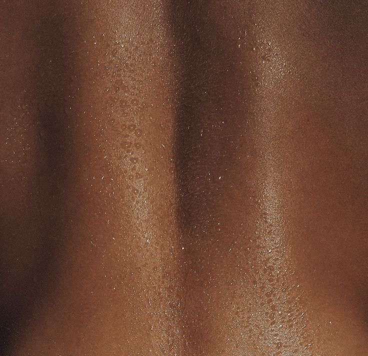 5 Sesiones de Dep. Láser Mit. Espal at LeBeau Esthétique in Humacao, PR